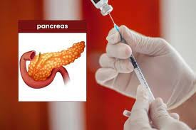 Avances en la lucha contra el Cáncer de Páncreas 
